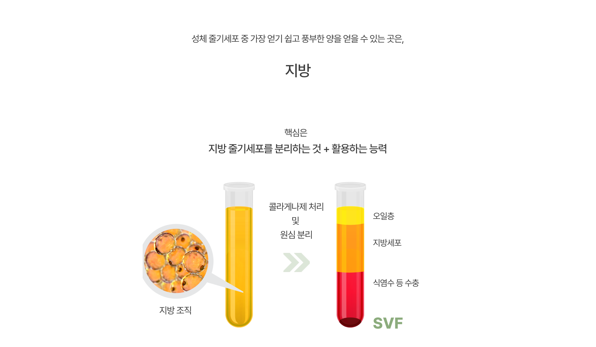 줄기세포 지방이식